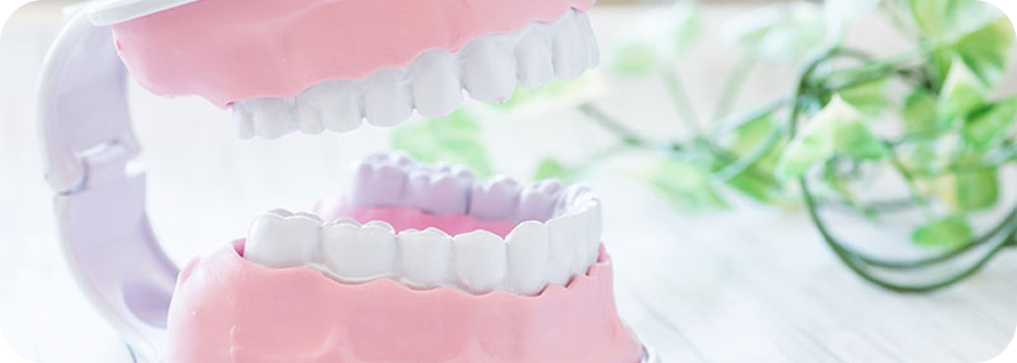 バネなし入れ歯